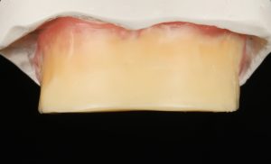 Maxilla Bite Block Unmarked